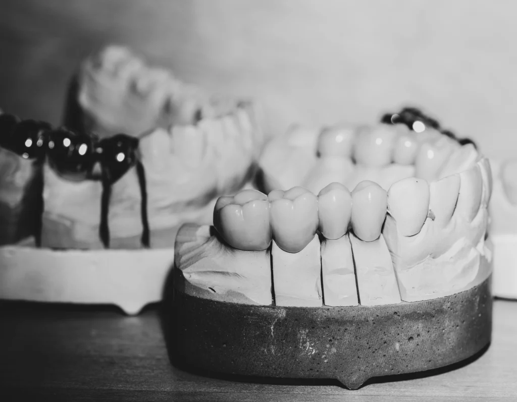 Fotografie von Implantatsmodell